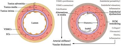An emerging view on vascular fibrosis molecular mediators and relevant disorders: from bench to bed